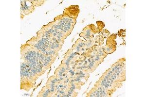 Immunohistochemistry of paraffin embedded mouse duodenum using SLC6A19 (ABIN7075682) at dilution of 1:900 (400x lens)