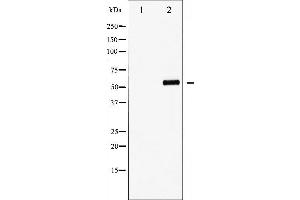FOXO4 antibody  (pThr451)