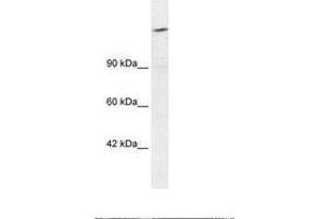 Image no. 1 for anti-AT Rich Interactive Domain 4A (RBP1-Like) (ARID4A) (AA 1119-1168) antibody (ABIN202981) (ARID4A antibody  (AA 1119-1168))