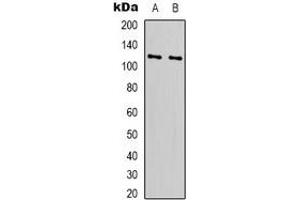 Western blot analysis of RPS6KC1 expression in Hela (A), HEK293T (B) whole cell lysates. (RPS6KC1 antibody)