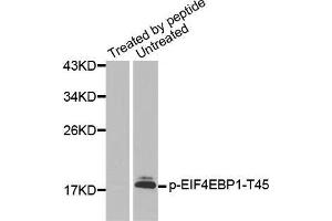 Western blot analysis of extracts from Hela cells using Phospho-EIF4EBP1-T45 antibody. (eIF4EBP1 antibody  (pThr45))