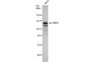 WB Image Desmocollin 2 antibody [C1C2], Internal detects Desmocollin 2 protein by western blot analysis. (Desmocollin 2 antibody)