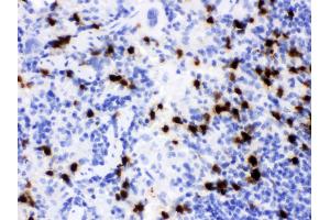 Immunohistochemistry (IHC) image for anti-Lipocalin 2 (LCN2) (AA 21-200) antibody (ABIN3043290)