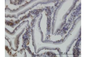 Immunoperoxidase of monoclonal antibody to RICTOR on formalin-fixed paraffin-embedded human small Intestine. (RICTOR antibody  (AA 1-98))