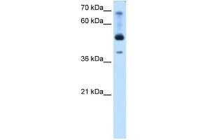 WB Suggested Anti-TFAP2B Antibody Titration:  0. (TFAP2B antibody  (N-Term))