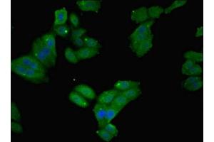 Immunofluorescent analysis of HepG2 cells using ABIN7152720 at dilution of 1:100 and Alexa Fluor 488-congugated AffiniPure Goat Anti-Rabbit IgG(H+L) (FTL antibody  (AA 2-175))