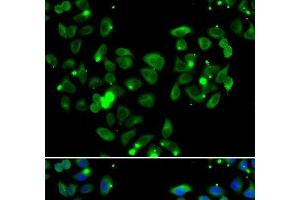Immunofluorescence analysis of A549 cells using CARD11 Polyclonal Antibody