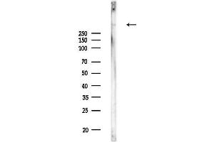 Western blot analysis of lysates from Rat kidney, using MUC5A Antibody at 1/1000 dilution.