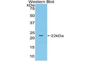 Western blot analysis of the recombinant protein. (Peroxiredoxin 6 antibody  (AA 1-224))