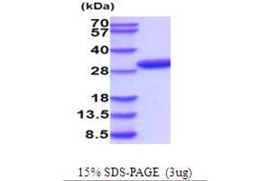 SDS-PAGE (SDS) image for phosphoribosyl Pyrophosphate Synthetase 2 (PRPS2) (AA 1-321) protein (His tag) (ABIN5854265) (PRPS2 Protein (AA 1-321) (His tag))