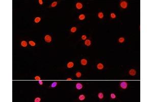 Immunofluorescence analysis of C6 cells using DiMethyl-DNMT3A-K44 Polyclonal Antibody at dilution of 1:100. (DNMT3A antibody  (2meLys44))