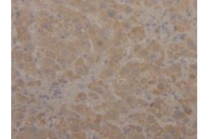 DAB staining on IHC-P; Samples: Human Liver Tissue (ALDH2 antibody  (AA 59-150))