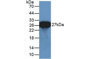 Detection of Recombinant GFP using Polyclonal Antibody to Green Fluorescent Protein (GFP) (GFP antibody  (AA 1-238))
