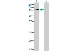 Western Blotting (WB) image for anti-T-Box 2 (TBX2) (AA 603-702) antibody (ABIN563097)