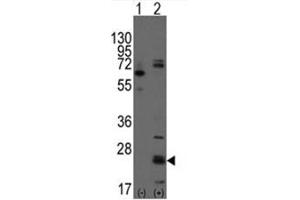 Image no. 1 for anti-CD9 (CD9) (N-Term) antibody (ABIN357002)
