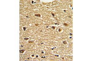 Formalin-fixed and paraffin-embedded human brain tissue reacted with ETV4 Antibody (C-term), which was peroxidase-conjugated to the secondary antibody, followed by DAB staining. (ETV4 antibody  (C-Term))