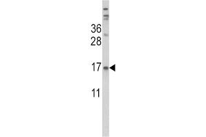 Western Blotting (WB) image for anti-Transthyretin (TTR) antibody (ABIN3002756) (TTR antibody)
