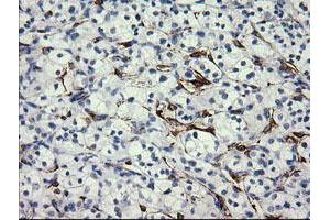 Image no. 1 for anti-Fetal and Adult Testis Expressed 1 (FATE1) antibody (ABIN1498223)
