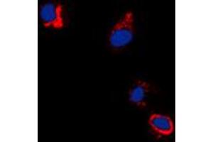 Immunofluorescent analysis of EPHB1/2 (pY594/604) staining in A431 cells. (EPHB1/2 antibody  (pTyr594, pTyr604))