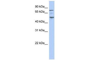 CK1 epsilon antibody used at 1 ug/ml to detect target protein. (CK1 epsilon antibody  (N-Term))
