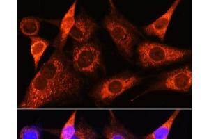 Immunofluorescence analysis of NIH-3T3 cells using PSAT1 Polyclonal Antibody at dilution of 1:100 (40x lens).