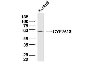 Hcclm3 lysates probed with CYP2A13 Polyclonal Antibody, Unconjugated  at 1:300 dilution and 4˚C overnight incubation.