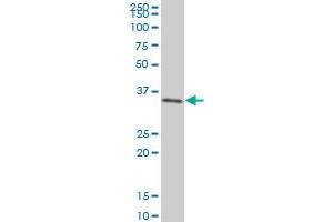 SIX3 monoclonal antibody (M01), clone 3D12 Western Blot analysis of SIX3 expression in 293 . (SIX3 antibody  (AA 273-332))