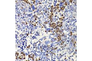 Immunohistochemistry of paraffin-embedded rat spleen using IL21 antibody. (IL-21 antibody  (AA 25-162))