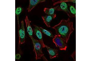 Immunofluorescence analysis of Hela cells using NBN mouse mAb (green).
