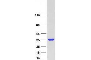 Validation with Western Blot
