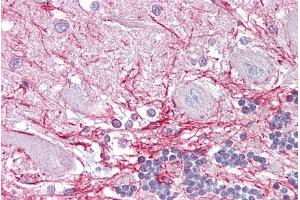 Immunohistochemistry with Brain, cerebellum tissue at an antibody concentration of 5µg/ml using anti-RP2 antibody (ARP56724_P050) (RP2 antibody  (Middle Region))