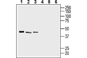 Western blot analysis of human HUVEC endothelial cell line lysate (lanes 1 and 4), human SH-SY5Y neuroblastoma cell line lysate (lanes 2 and 5) and human  MG glioblastoma cell line lysate (lanes 3 and 6):1-3.
