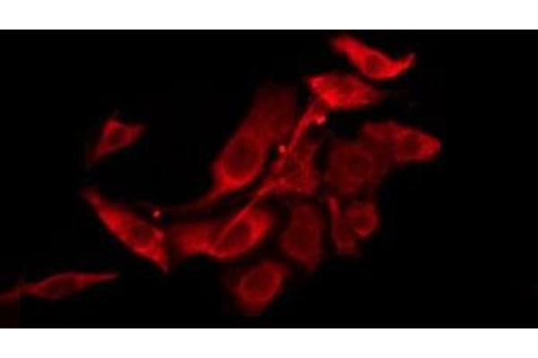 TAS2R39 antibody  (Internal Region)