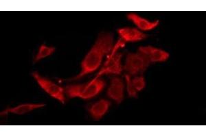 ABIN6276223 staining HepG2 by IF/ICC. (TAS2R39 antibody  (Internal Region))
