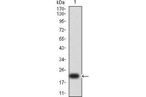 Western blot analysis using SP17 mAb against human SP17 (AA: 1-152) recombinant protein. (SPA17 antibody  (AA 1-152))