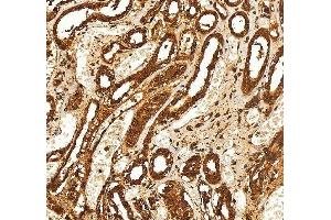 IHC analysis of SELENBP1 using anti-SELENBP1 antibody (ABIN7600755). (SELENBP1 antibody  (AA 23-462))