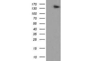 Western Blotting (WB) image for anti-ATP/GTP Binding Protein 1 (AGTPBP1) (AA 368-753) antibody (ABIN1491459) (AGTPBP1 antibody  (AA 368-753))