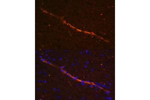 Immunofluorescence analysis of rat brain using CD34 antibody (ABIN6134661, ABIN6138169, ABIN6138171 and ABIN6218103) at dilution of 1:100. (CD34 antibody  (C-Term))