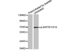 Western blot analysis of extracts from Jurkat cells, using phospho-ZAP70-Y319 antibody. (ZAP70 antibody  (pTyr319))