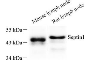 Western blot analysis of Septin1 (ABIN7074453) at dilution of 1: 500