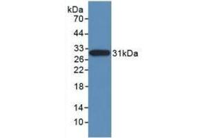 Detection of Recombinant NES, Human using Monoclonal Antibody to Nestin (NES) (Nestin antibody  (AA 178-399))