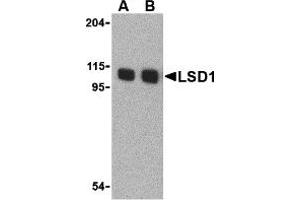 Western Blotting (WB) image for anti-Lysine (K)-Specific Demethylase 1A (KDM1A) (N-Term) antibody (ABIN1031442) (LSD1 antibody  (N-Term))
