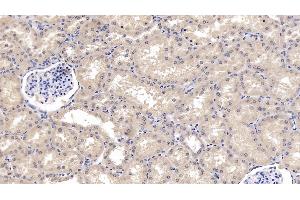 Immunohistochemistry (IHC) image for anti-Wingless-Type MMTV Integration Site Family, Member 4 (WNT4) (AA 26-351) antibody (ABIN7427258)