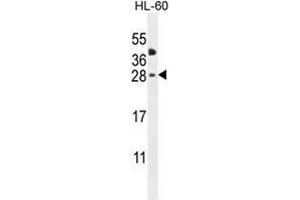 CLEC2A Antibody (Center) western blot analysis in HL-60 cell line lysates (35µg/lane). (CLEC2A antibody  (Middle Region))