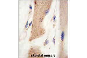 Formalin-fixed and paraffin-embedded human skeletal muscle tissue reacted with CDH15 polyclonal antibody  , which was peroxidase-conjugated to the secondary antibody, followed by DAB staining. (CDH15 antibody  (C-Term))