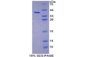 SDS-PAGE (SDS) image for Trophoblast Glycoprotein (TPBG) (AA 32-351) protein (His tag) (ABIN2127087)