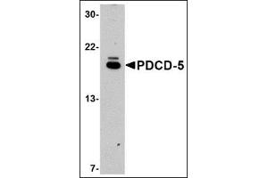 Western blot analysis of PDCD5 in EL4 cell lysate with this product at 1μg/ml. (PDCD5 antibody  (C-Term))