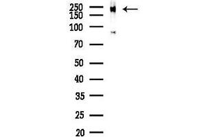 Western blot analysis of lysates from COLO205 cells(heat-shock,45 min treatment), using Phospho-TRAP220/ME (Thr1457) Antibody at 1/1000 dilution.