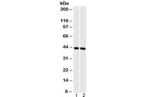 Western blot testing of 1) human muscle and 2) mouse muscle cell lysate with Muscle Actin antibody (clone HHF35). (Actin antibody)