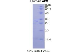 SDS-PAGE of Protein Standard from the Kit (Highly purified E. (alpha 2 Macroglobulin ELISA Kit)